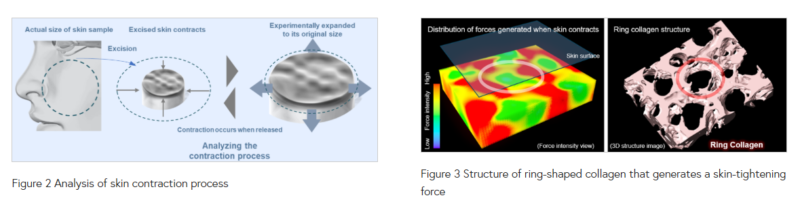 Unlocking Ring Collagen®: A New Frontier in Targeting Facial Sagging